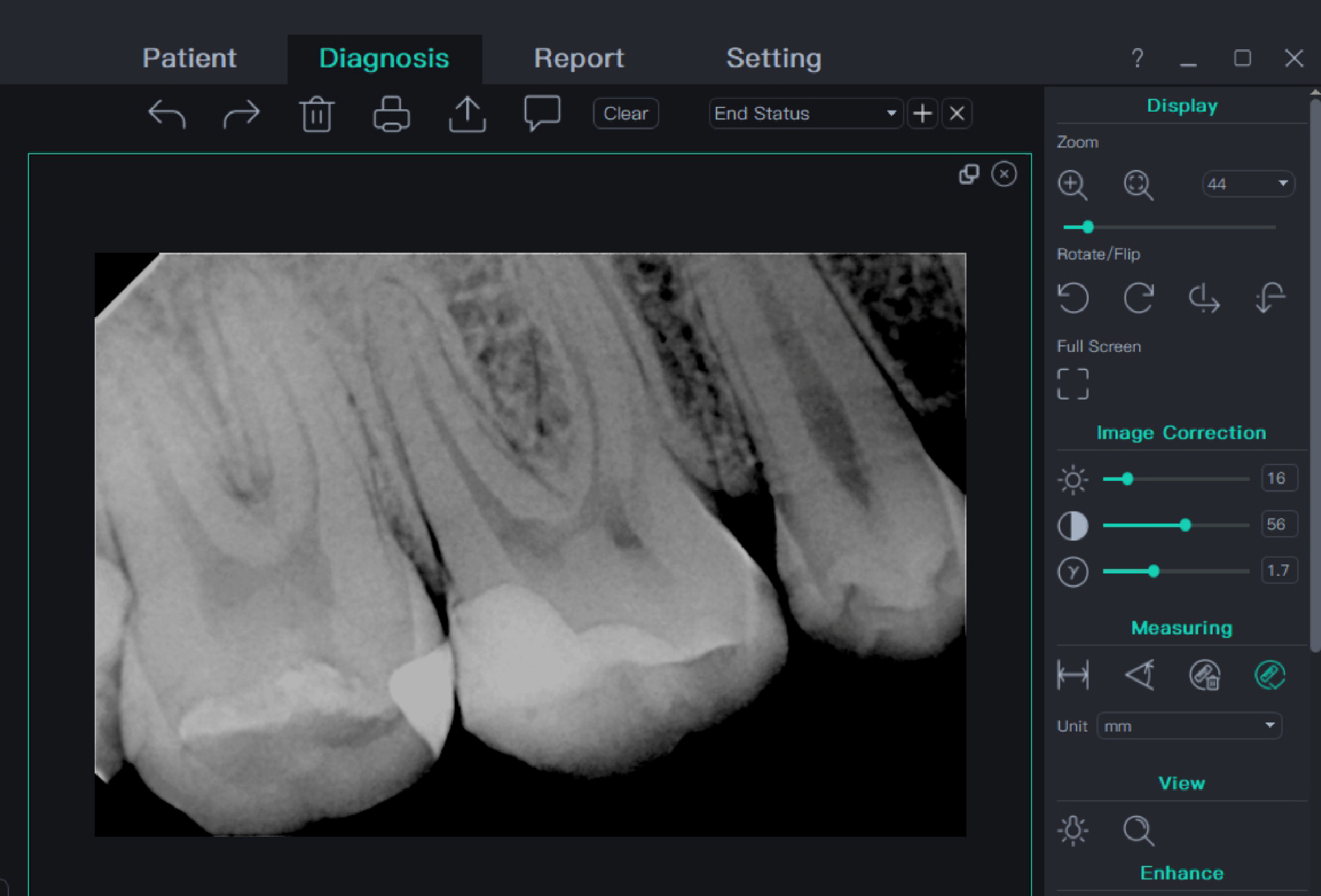 Odoo - Prueba 1 a tres columnas