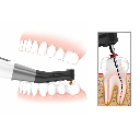 Micromotor para Endodoncia Mecanizada + Localizador, ENDOMATIC. DTE WOODPECKER