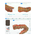 Scanner intraoral 3D, New Aoralscan 3. SHINING 3D