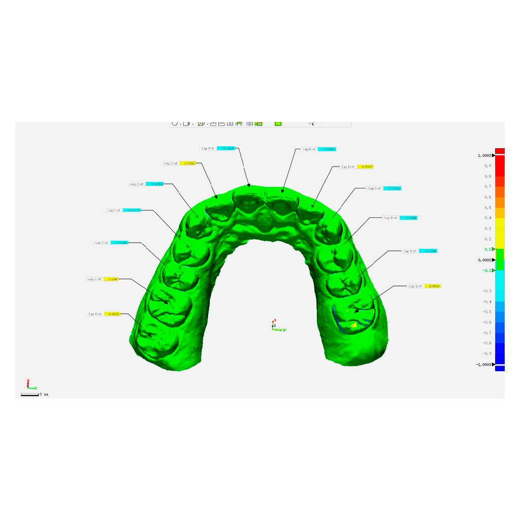 Scanner intraoral 3D, New Aoralscan 3. SHINING 3D