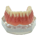 Modelo acrilico de sobredentadura con pilares esféricos. ML